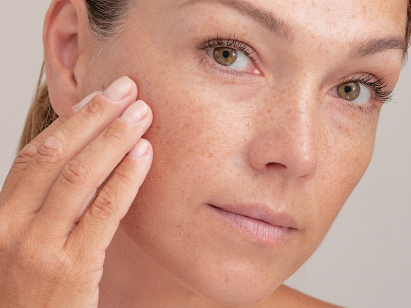 Traitement IPL chez Estetica Javea : Élimination des Varicosités et Taches pour une Peau Radieuse