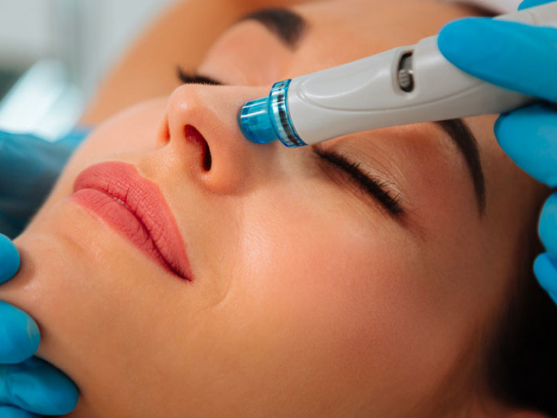 HydraFacial à Javea: Soin du Visage 4-en-1 Innovant | Estetica Javea