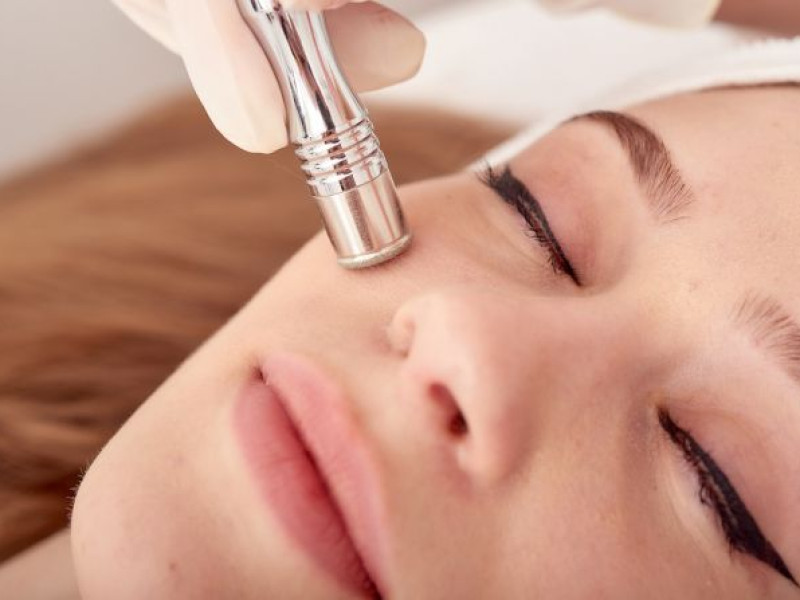 Découvrez les Avantages de la Microdermabrasion chez Estetica Javea