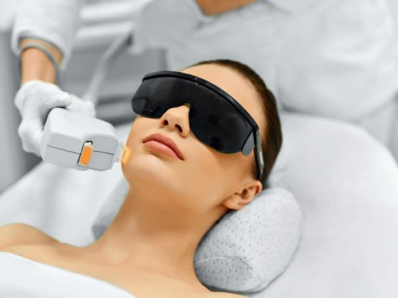 Traitements au Laser de la Peau avec IPL à Javea : Expertise Personnalisée du Dr. Caroline Carbasse