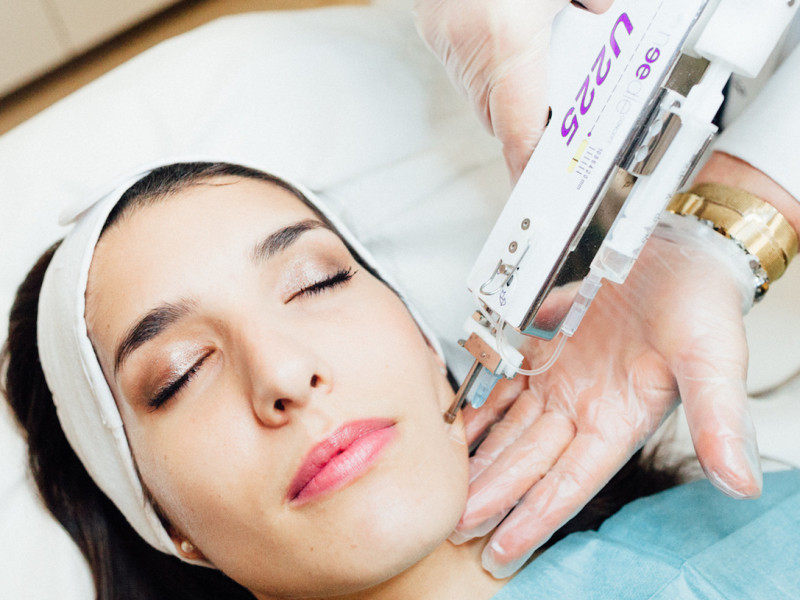 Mésothérapie Faciale à Javea: Rajeunissement et Revitalisation | Estetica Javea - Dr Caroline Carbasse