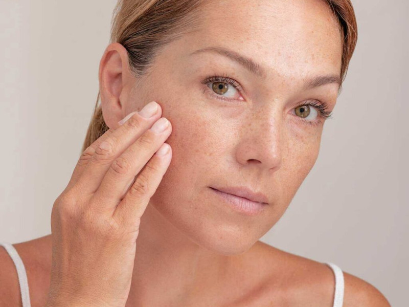 Dites Adieu aux Varicosités et Taches avec le Traitement IPL chez Dr Caroline Carbasse à Estetica Javea